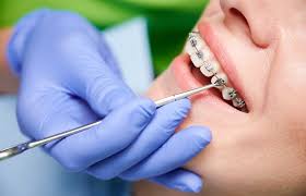 Orthodontics / Braces