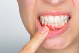 Periodontal / Gum Care