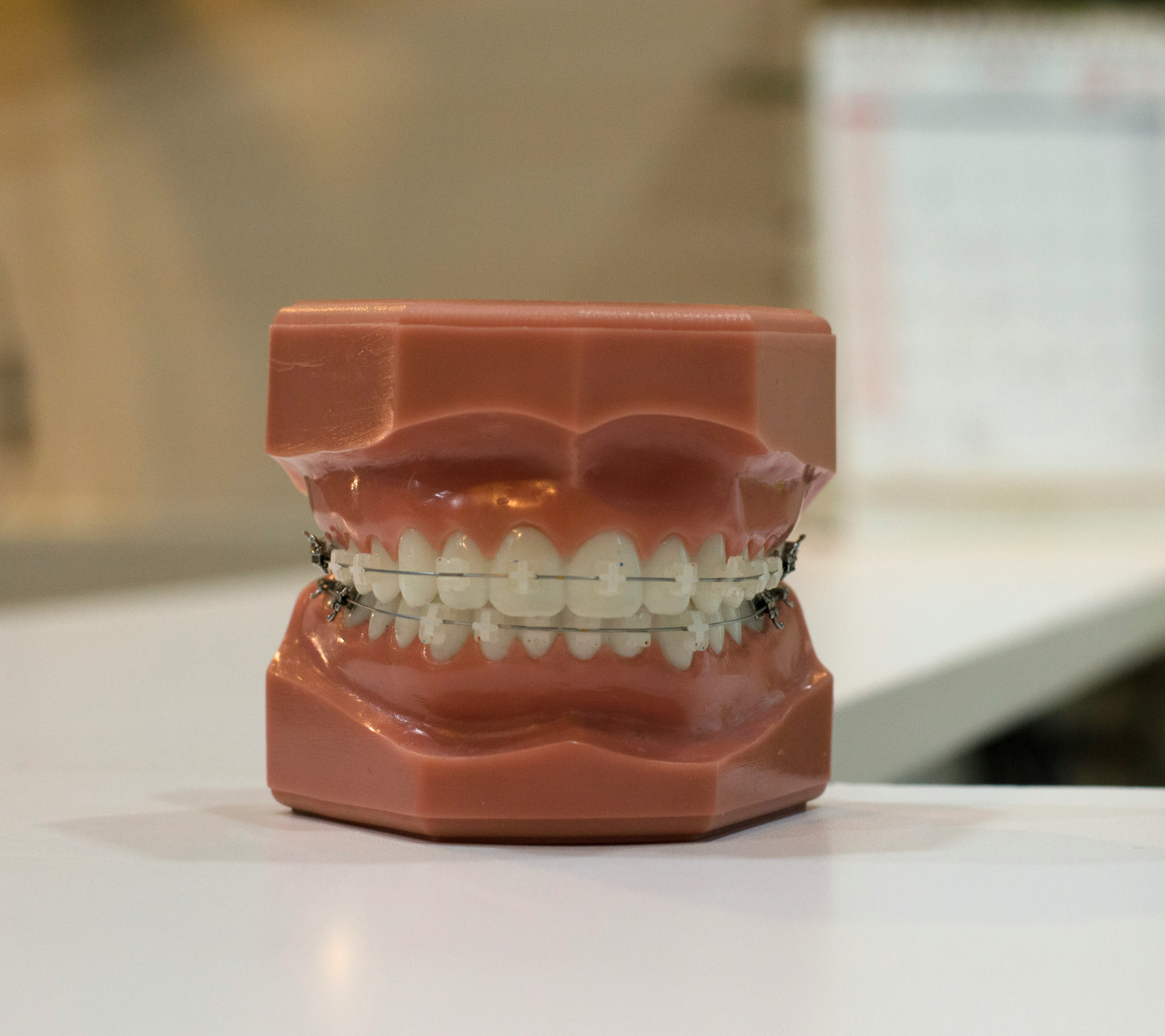Aligners Treatment